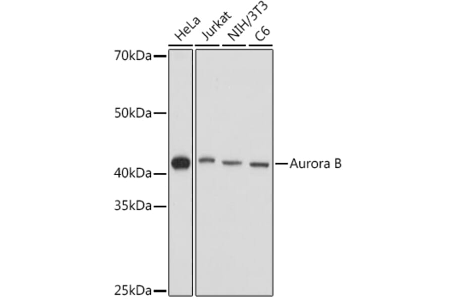 Western Blot - Anti-Aurora B Antibody (A92918) - Antibodies.com