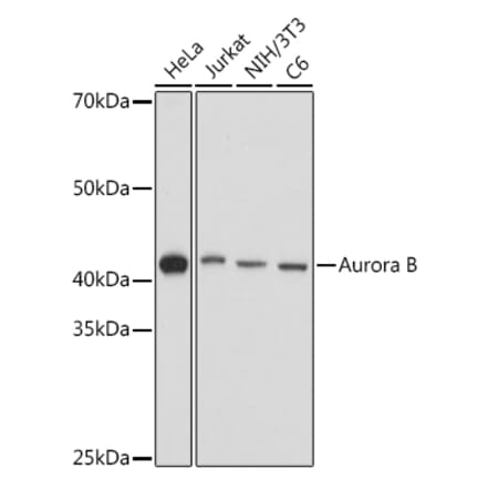 Western Blot - Anti-Aurora B Antibody (A92918) - Antibodies.com
