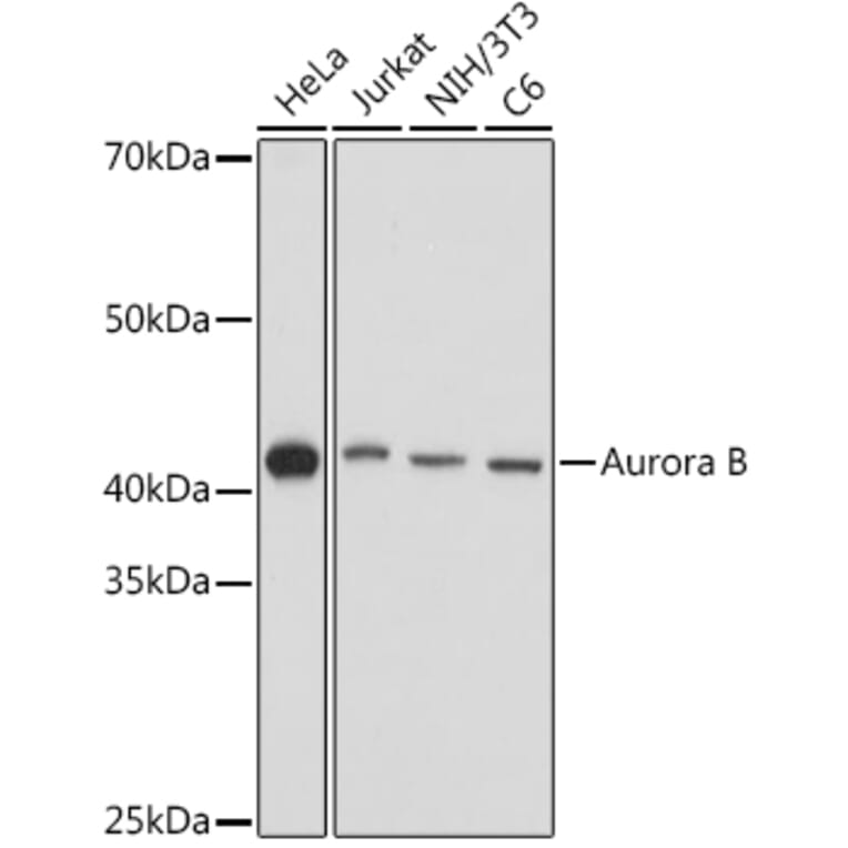 Western Blot - Anti-Aurora B Antibody (A92918) - Antibodies.com