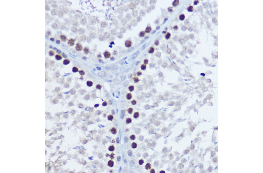 Immunohistochemistry - Anti-Aurora B Antibody (A92918) - Antibodies.com