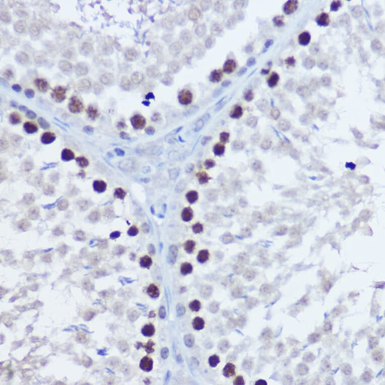 Immunohistochemistry - Anti-Aurora B Antibody (A92918) - Antibodies.com