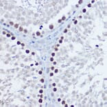 Immunohistochemistry - Anti-Aurora B Antibody (A92918) - Antibodies.com