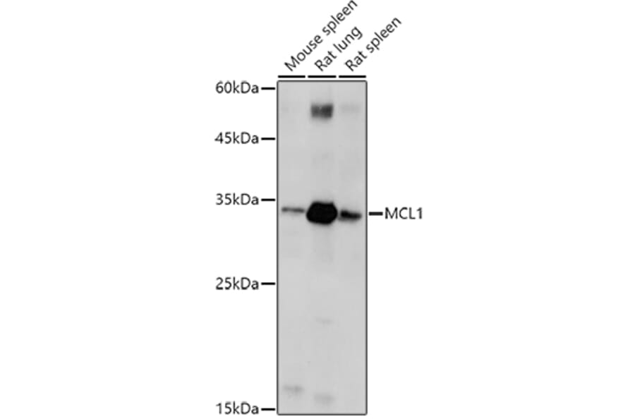 Western Blot - Anti-MCL1 Antibody (A92920) - Antibodies.com