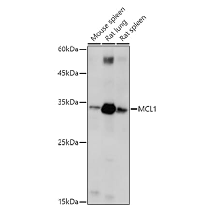 Western Blot - Anti-MCL1 Antibody (A92920) - Antibodies.com