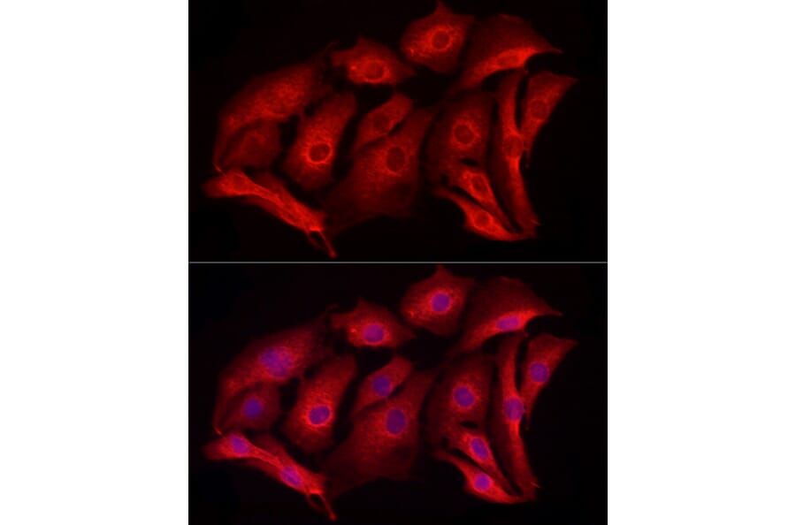 Immunofluorescence - Anti-MCL1 Antibody (A92920) - Antibodies.com