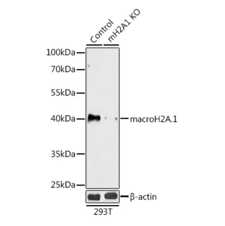 Western Blot - Anti-mH2A1 Antibody (A92921) - Antibodies.com
