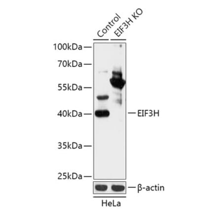 Western Blot - Anti-EIF3H Antibody (A92922) - Antibodies.com