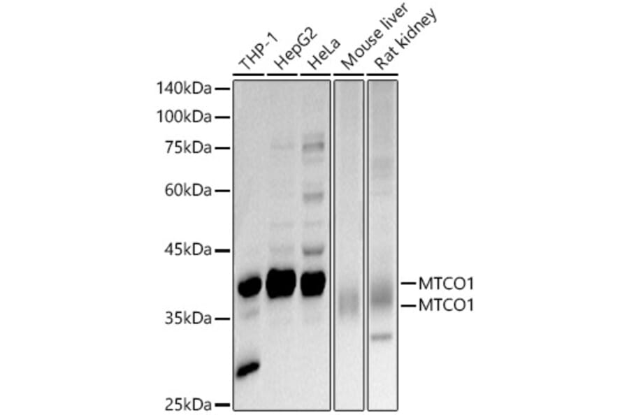 Western Blot - Anti-MTCO1 Antibody (A92923) - Antibodies.com