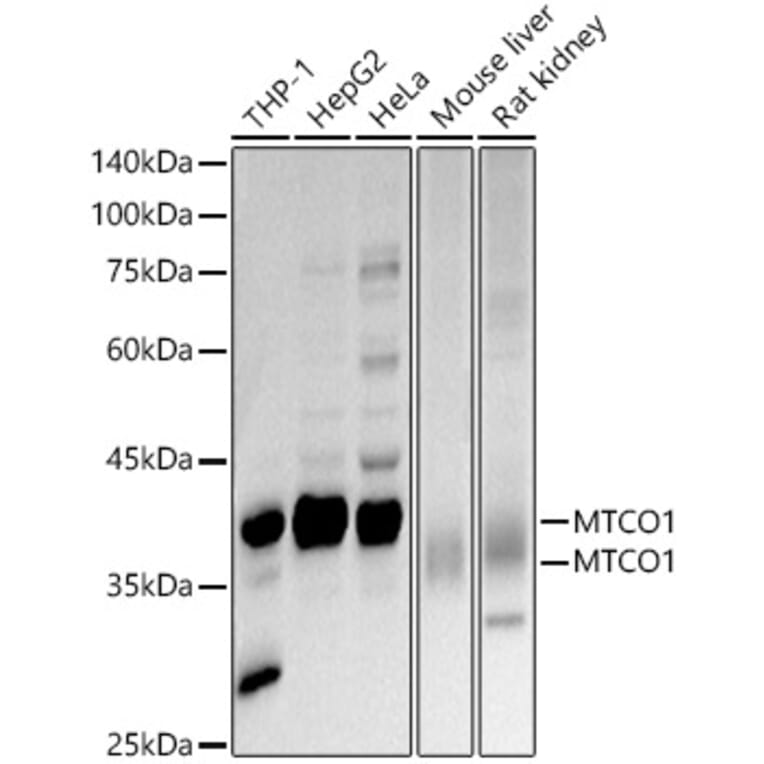 Western Blot - Anti-MTCO1 Antibody (A92923) - Antibodies.com