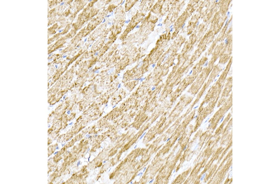 Immunohistochemistry - Anti-MTCO1 Antibody (A92923) - Antibodies.com