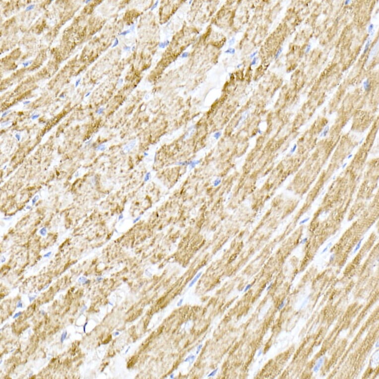 Immunohistochemistry - Anti-MTCO1 Antibody (A92923) - Antibodies.com