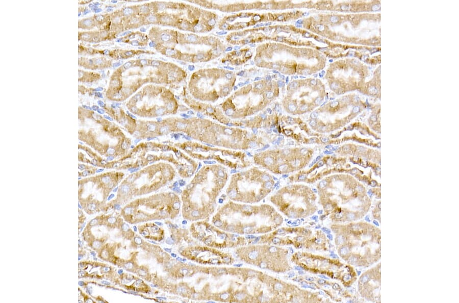 Immunohistochemistry - Anti-MTCO1 Antibody (A92923) - Antibodies.com