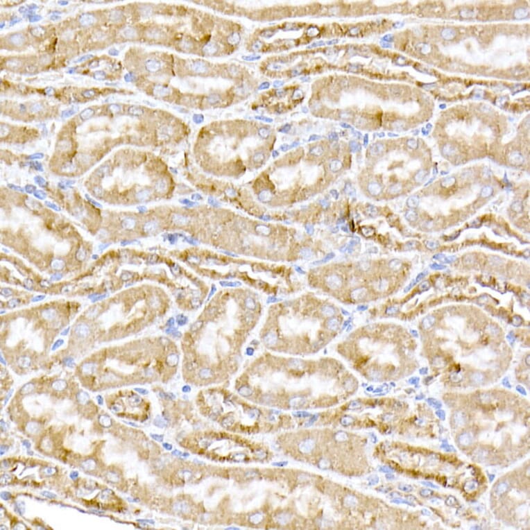 Immunohistochemistry - Anti-MTCO1 Antibody (A92923) - Antibodies.com