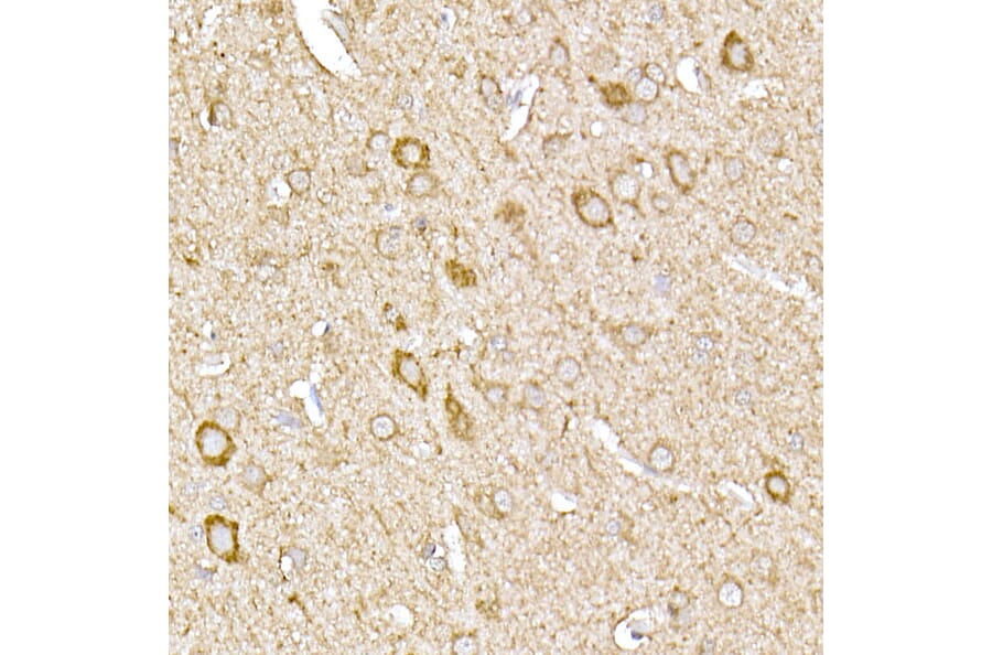 Immunohistochemistry - Anti-MTCO1 Antibody (A92923) - Antibodies.com