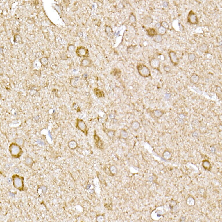 Immunohistochemistry - Anti-MTCO1 Antibody (A92923) - Antibodies.com