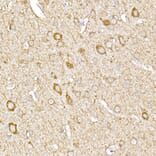 Immunohistochemistry - Anti-MTCO1 Antibody (A92923) - Antibodies.com