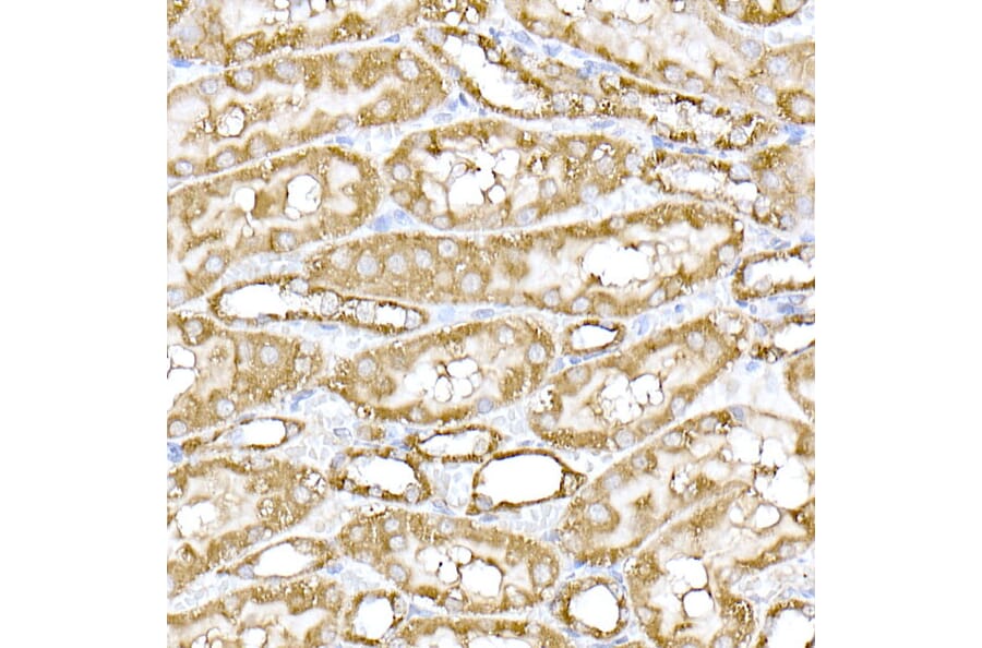 Immunohistochemistry - Anti-MTCO1 Antibody (A92923) - Antibodies.com