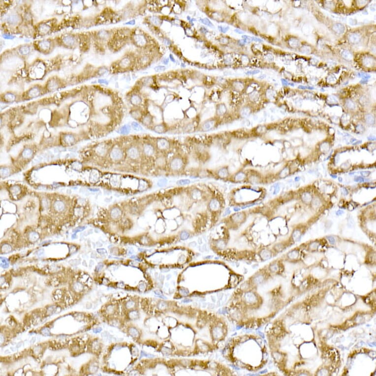 Immunohistochemistry - Anti-MTCO1 Antibody (A92923) - Antibodies.com