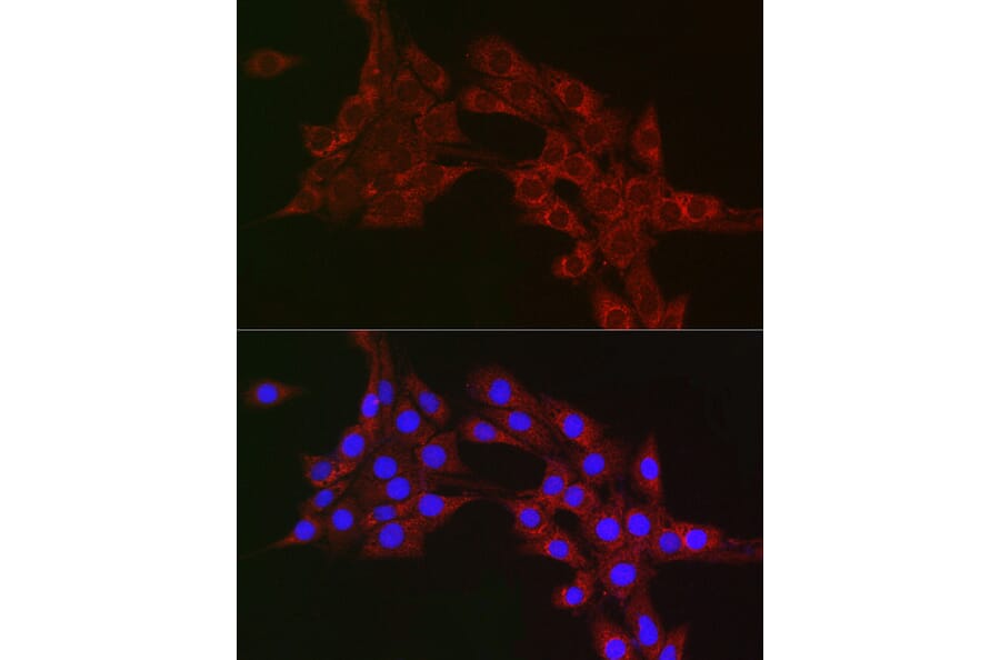 Immunofluorescence - Anti-MTCO1 Antibody (A92923) - Antibodies.com