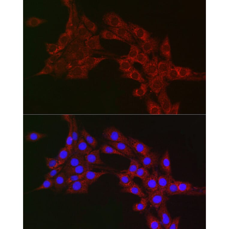 Immunofluorescence - Anti-MTCO1 Antibody (A92923) - Antibodies.com