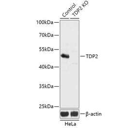 Western Blot - Anti-TDP2 Antibody (A92924) - Antibodies.com