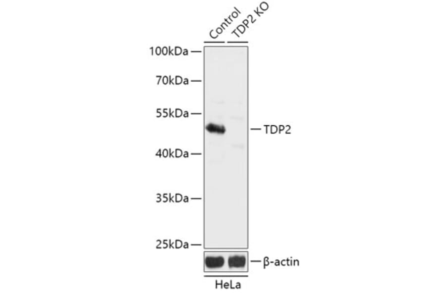 Western Blot - Anti-TDP2 Antibody (A92924) - Antibodies.com