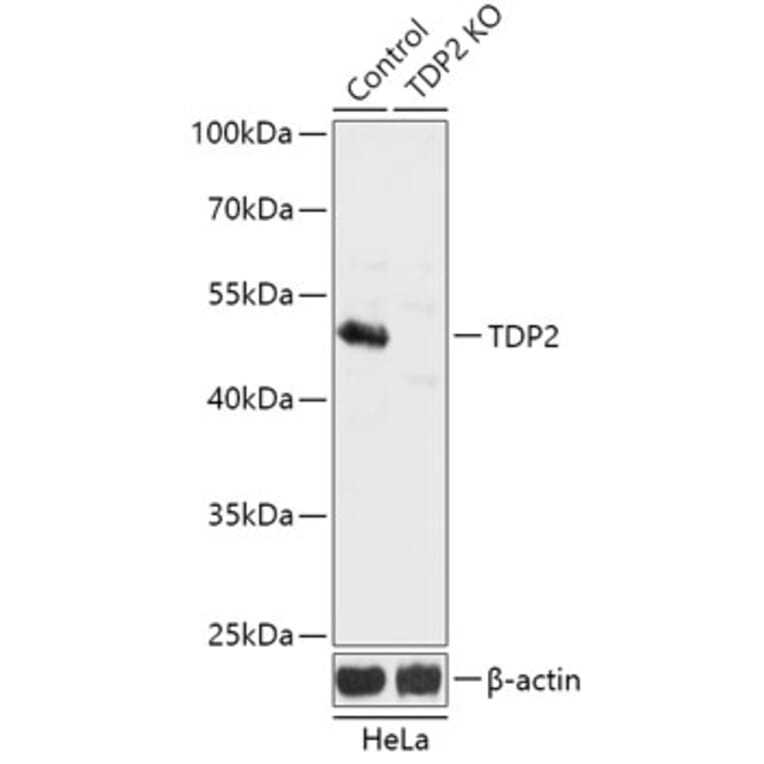 Western Blot - Anti-TDP2 Antibody (A92924) - Antibodies.com