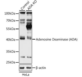 Western Blot - Anti-ADA Antibody (A92925) - Antibodies.com