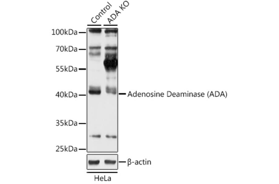Western Blot - Anti-ADA Antibody (A92925) - Antibodies.com