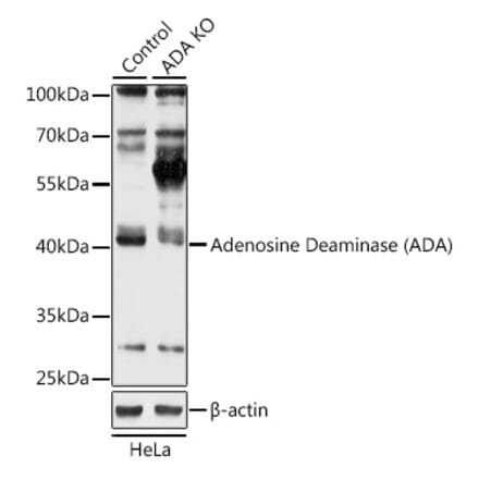 Western Blot - Anti-ADA Antibody (A92925) - Antibodies.com