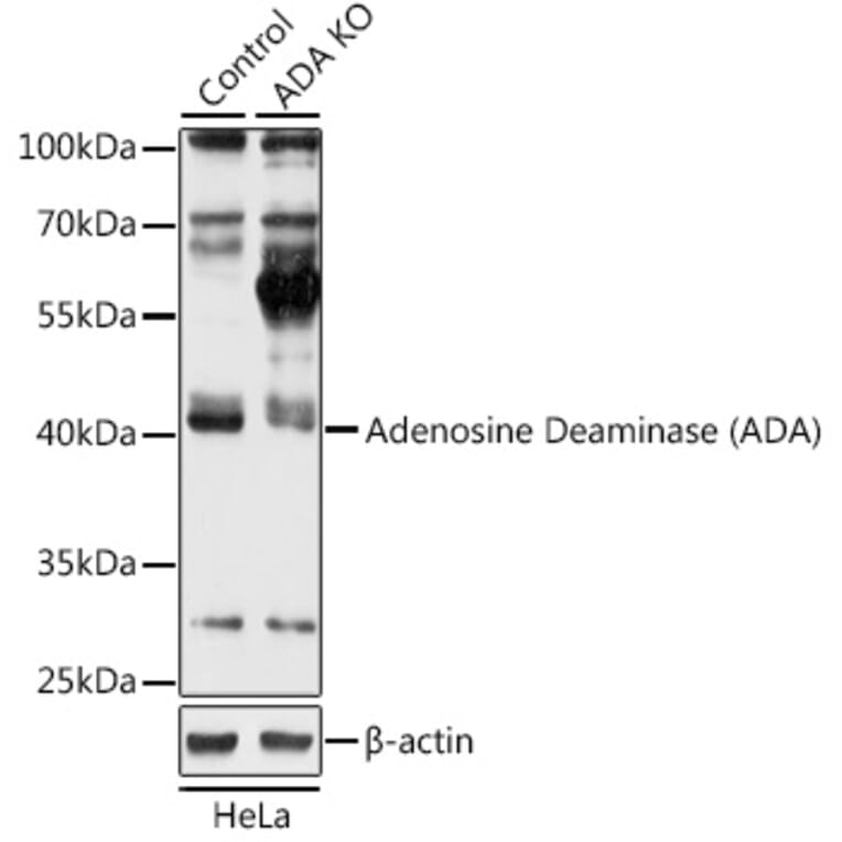 Western Blot - Anti-ADA Antibody (A92925) - Antibodies.com