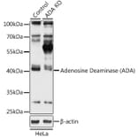Western Blot - Anti-ADA Antibody (A92925) - Antibodies.com
