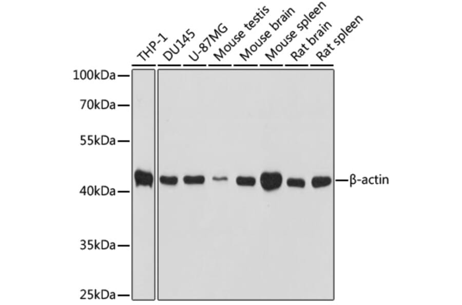 Western Blot - Anti-ACTB Antibody (AC037) - Antibodies.com