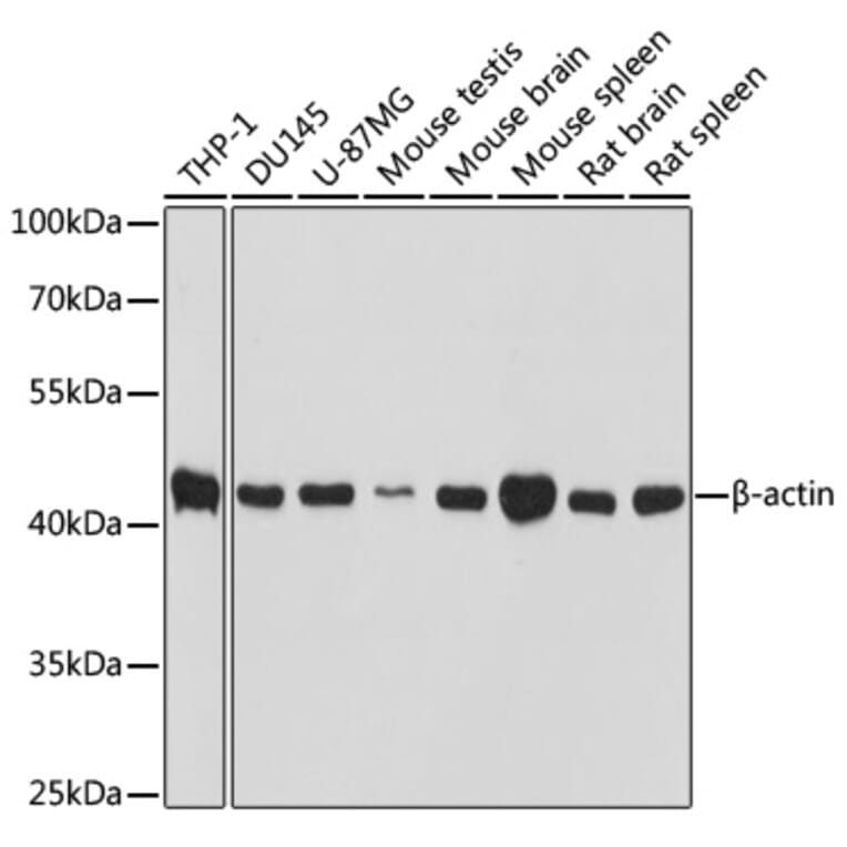 Western Blot - Anti-ACTB Antibody (AC037) - Antibodies.com