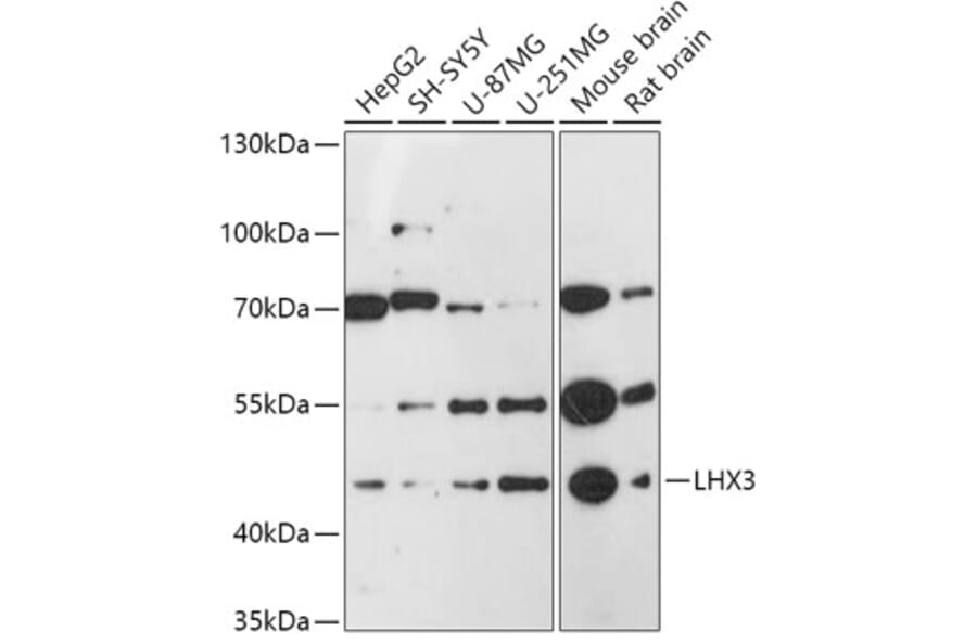 Western Blot - Anti-LHX3/LIM Antibody (A92931) - Antibodies.com