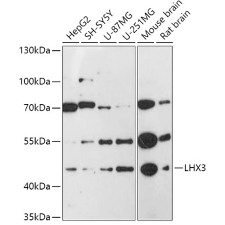 Western Blot - Anti-LHX3/LIM Antibody (A92931) - Antibodies.com
