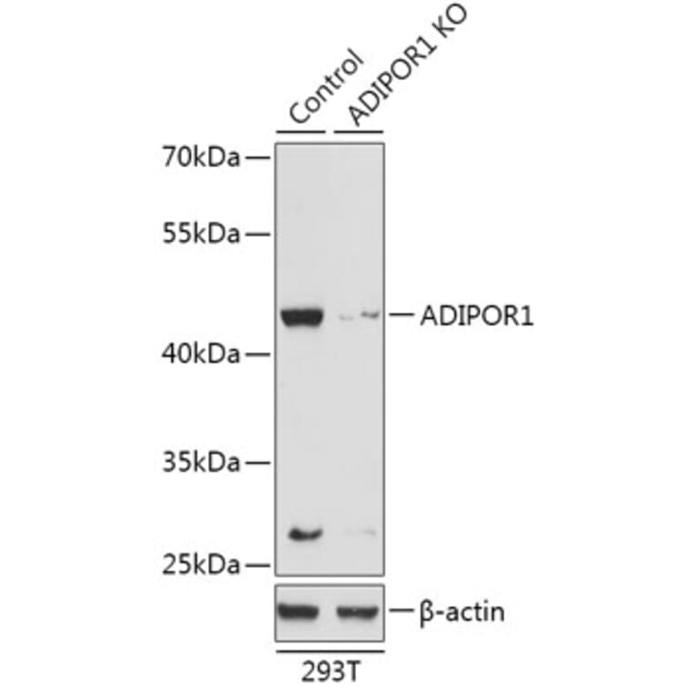 Western Blot - Anti-ADIPOR1 Antibody (A92932) - Antibodies.com