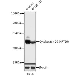 Western Blot - Anti-Cytokeratin 20 Antibody (A92935) - Antibodies.com