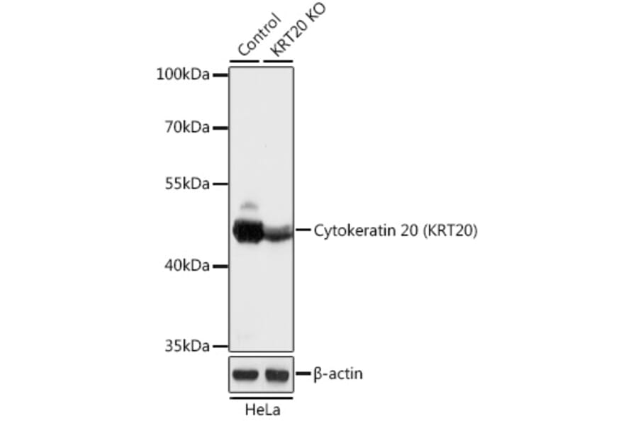 Western Blot - Anti-Cytokeratin 20 Antibody (A92935) - Antibodies.com