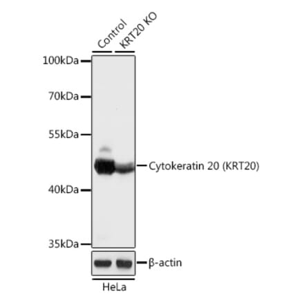 Western Blot - Anti-Cytokeratin 20 Antibody (A92935) - Antibodies.com