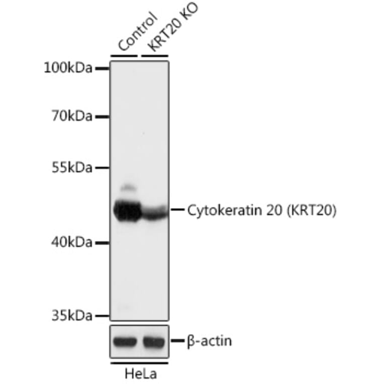 Western Blot - Anti-Cytokeratin 20 Antibody (A92935) - Antibodies.com