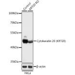 Western Blot - Anti-Cytokeratin 20 Antibody (A92935) - Antibodies.com