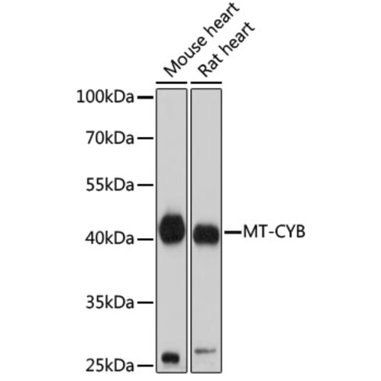 Western Blot - Anti-MT-CYB Antibody (A92936) - Antibodies.com