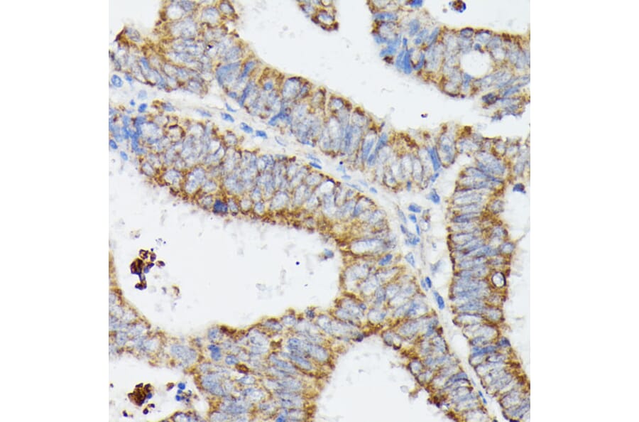 Immunohistochemistry - Anti-MT-CYB Antibody (A92936) - Antibodies.com