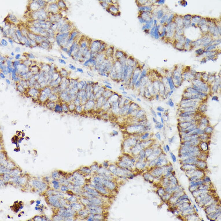 Immunohistochemistry - Anti-MT-CYB Antibody (A92936) - Antibodies.com