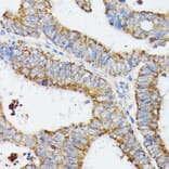 Immunohistochemistry - Anti-MT-CYB Antibody (A92936) - Antibodies.com