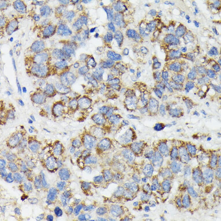 Immunohistochemistry - Anti-MT-CYB Antibody (A92936) - Antibodies.com