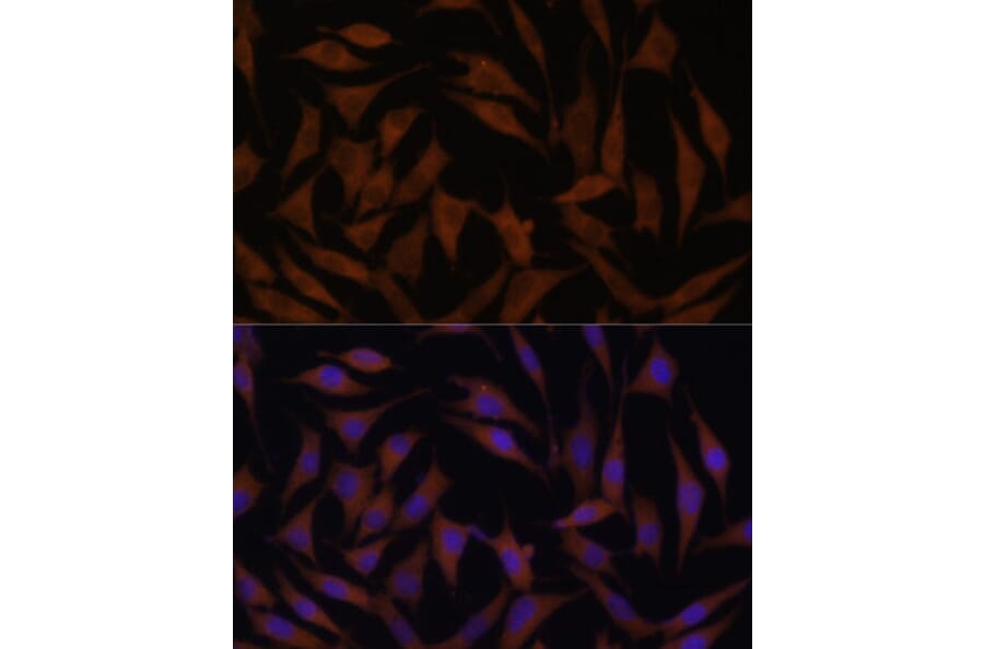 Immunofluorescence - Anti-MT-CYB Antibody (A92936) - Antibodies.com