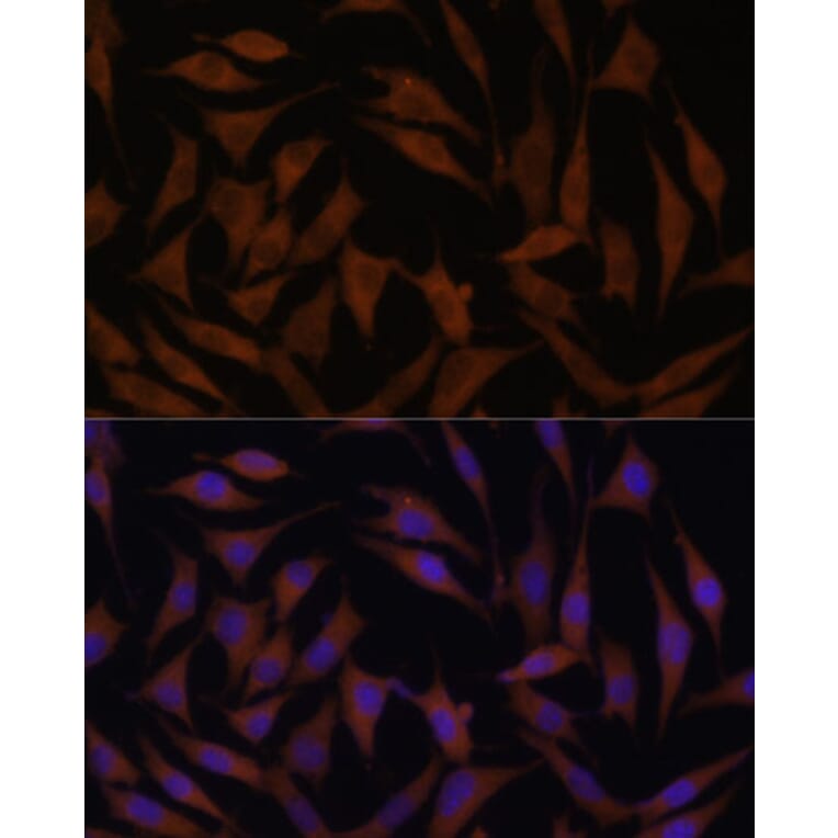 Immunofluorescence - Anti-MT-CYB Antibody (A92936) - Antibodies.com