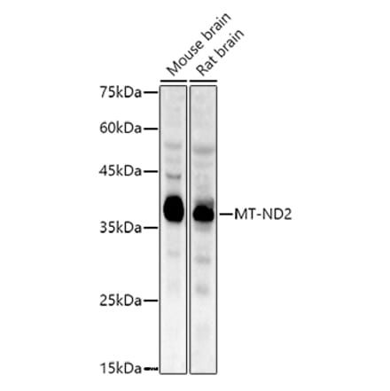 Western Blot - Anti-NADH2 [9E12-1B3] Antibody (A92937) - Antibodies.com